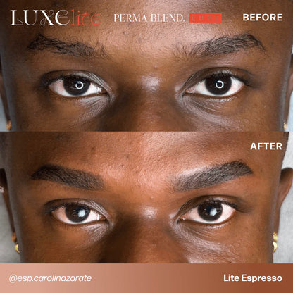 LUXE Lite Kit