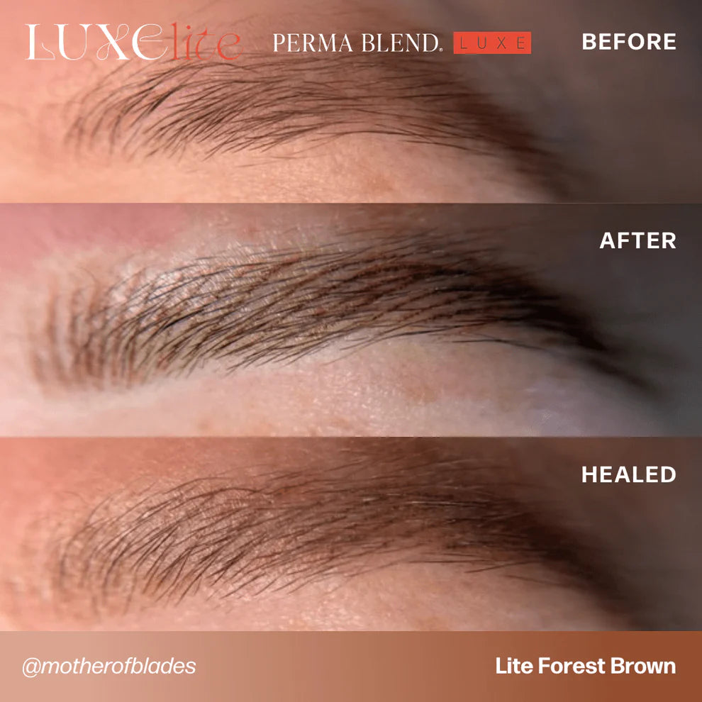 LUXE Lite Kit