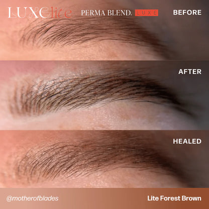 LUXE Lite Kit